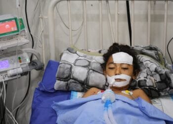 A bomb in Gaza’s rubble wounds twins who thought it was a toy