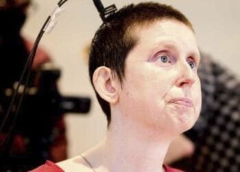 A stroke survivor speaks again with the help of an experimental brain-computer implant