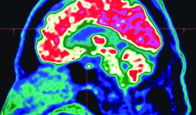 the full effect of microplastics on human health has not been understood photo afp