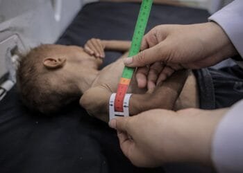 Food alone won’t save Gaza’s starving population