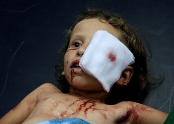 I was training to heal eyes in Gaza. Then everything went dark