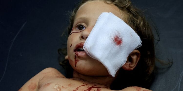 I was training to heal eyes in Gaza. Then everything went dark