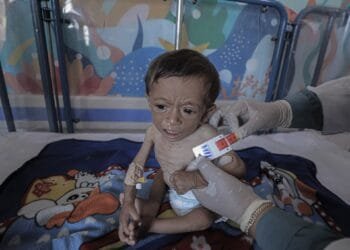 Israel starving Gaza: 263 dead from starvation, including 112 children