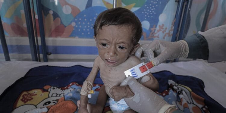 Israel starving Gaza: 263 dead from starvation, including 112 children