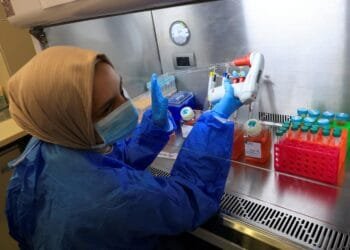 Liquor-linked liver deaths rising in women, young adults: Study