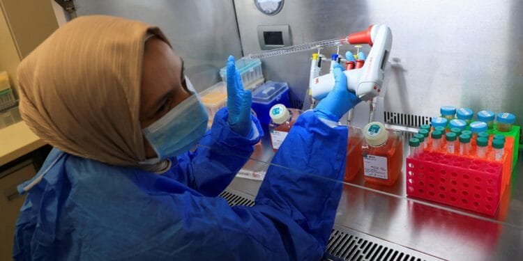 Liquor-linked liver deaths rising in women, young adults: Study