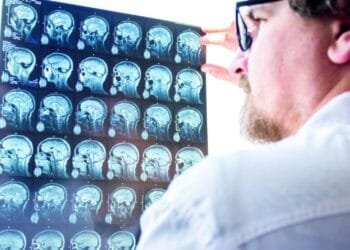 Men three times more likely to die from a brain injury, reveals study