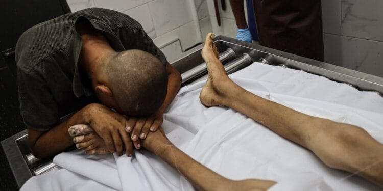 Palestinian boy, 17, dies of Israel-induced starvation in Gaza