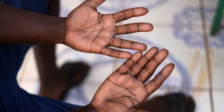 South African miner describes horrors for those who spent months underground