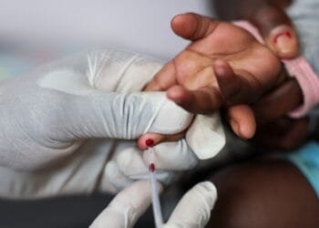 US aid cuts could lead to millions more HIV/AIDS deaths by 2029, UN warns