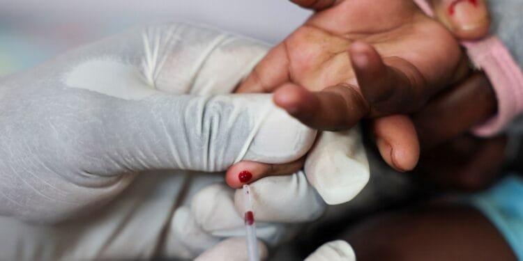 US aid cuts could lead to millions more HIV/AIDS deaths by 2029, UN warns