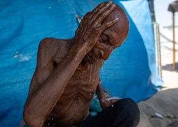 What ‘starvation’ really means, for the human body and for Gaza