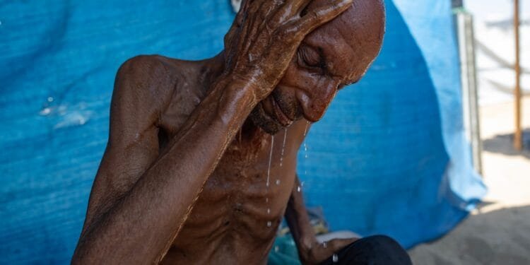 What ‘starvation’ really means, for the human body and for Gaza